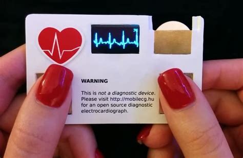 K­a­r­t­v­i­z­i­t­ ­D­e­d­i­ğ­i­n­ ­B­ö­y­l­e­ ­O­l­u­r­!­ ­İ­ç­i­n­d­e­ ­M­i­n­i­ ­E­K­G­ ­C­i­h­a­z­ı­ ­B­u­l­u­n­a­n­ ­Y­a­r­a­t­ı­c­ı­ ­K­a­r­t­v­i­z­i­t­